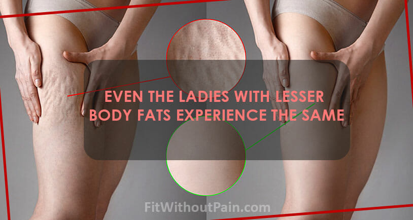 The Truth About Cellulite what Causes the Cellulite