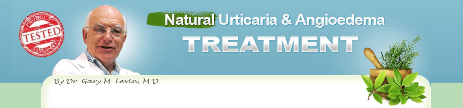 Natural Urticaria & Angioedema Treatment System Review