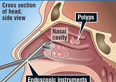 What Are The Results Of This Treatment