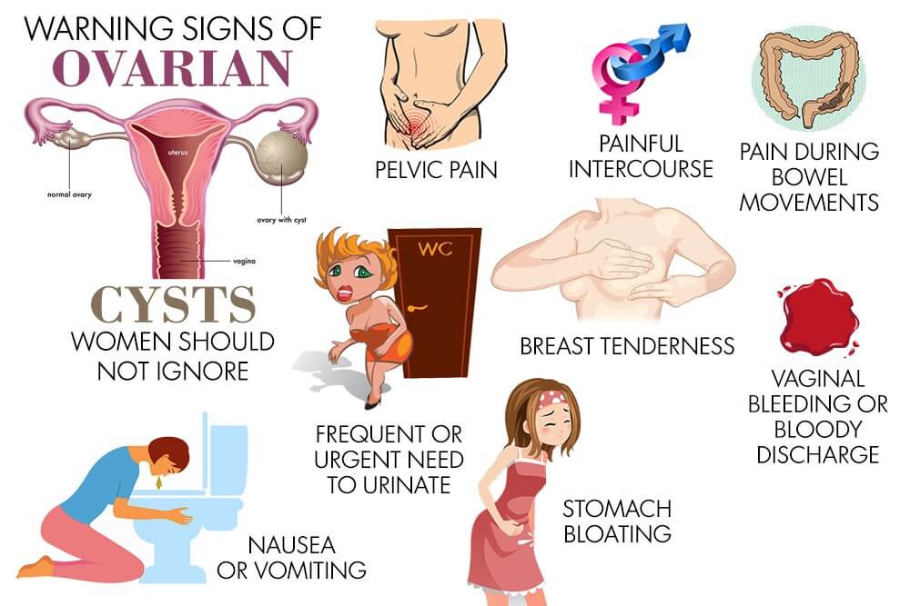 Symptoms of cysts!