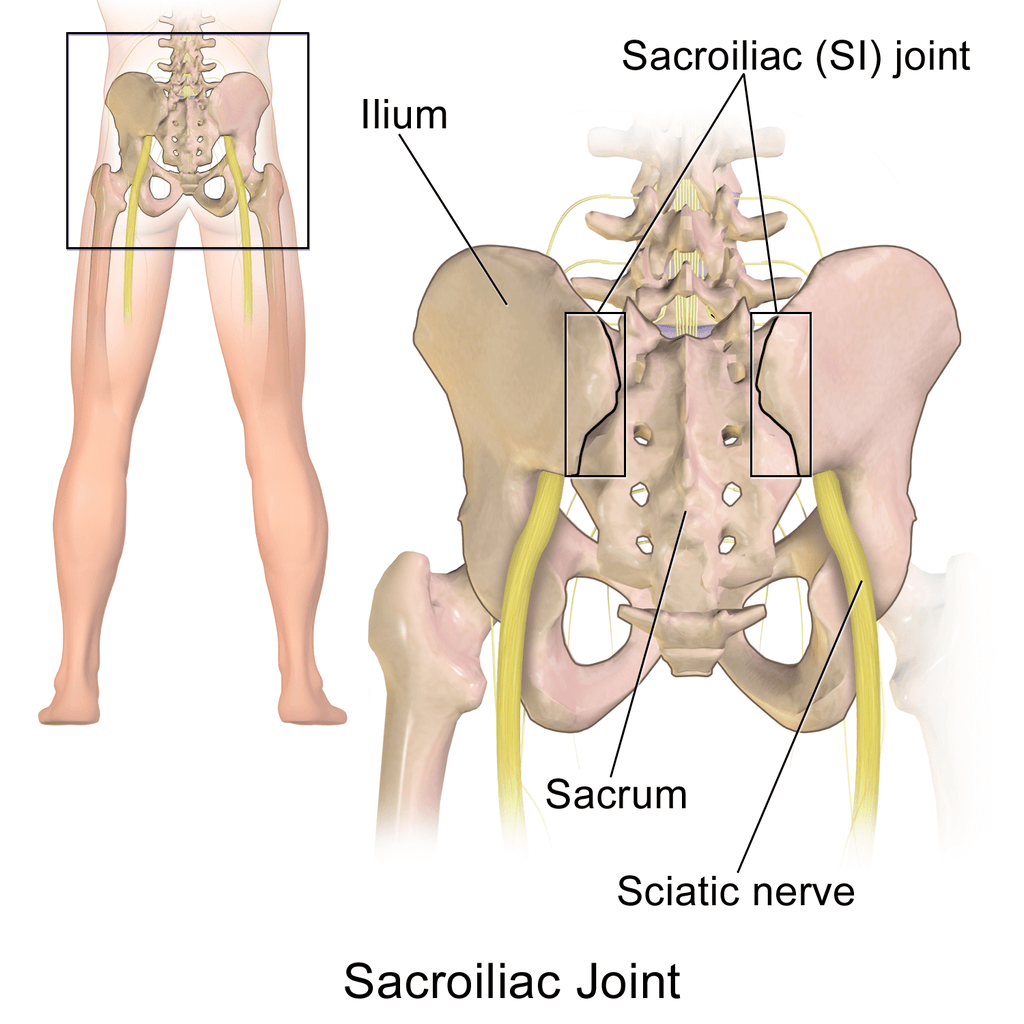 So what is sciatica